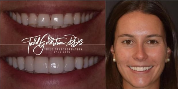 Images Todd Goldstein DDS