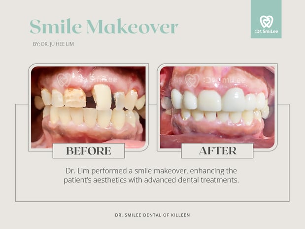 Images Dr Smilee Dental of Killeen, Family, Cosmetic, Implant, Medspa