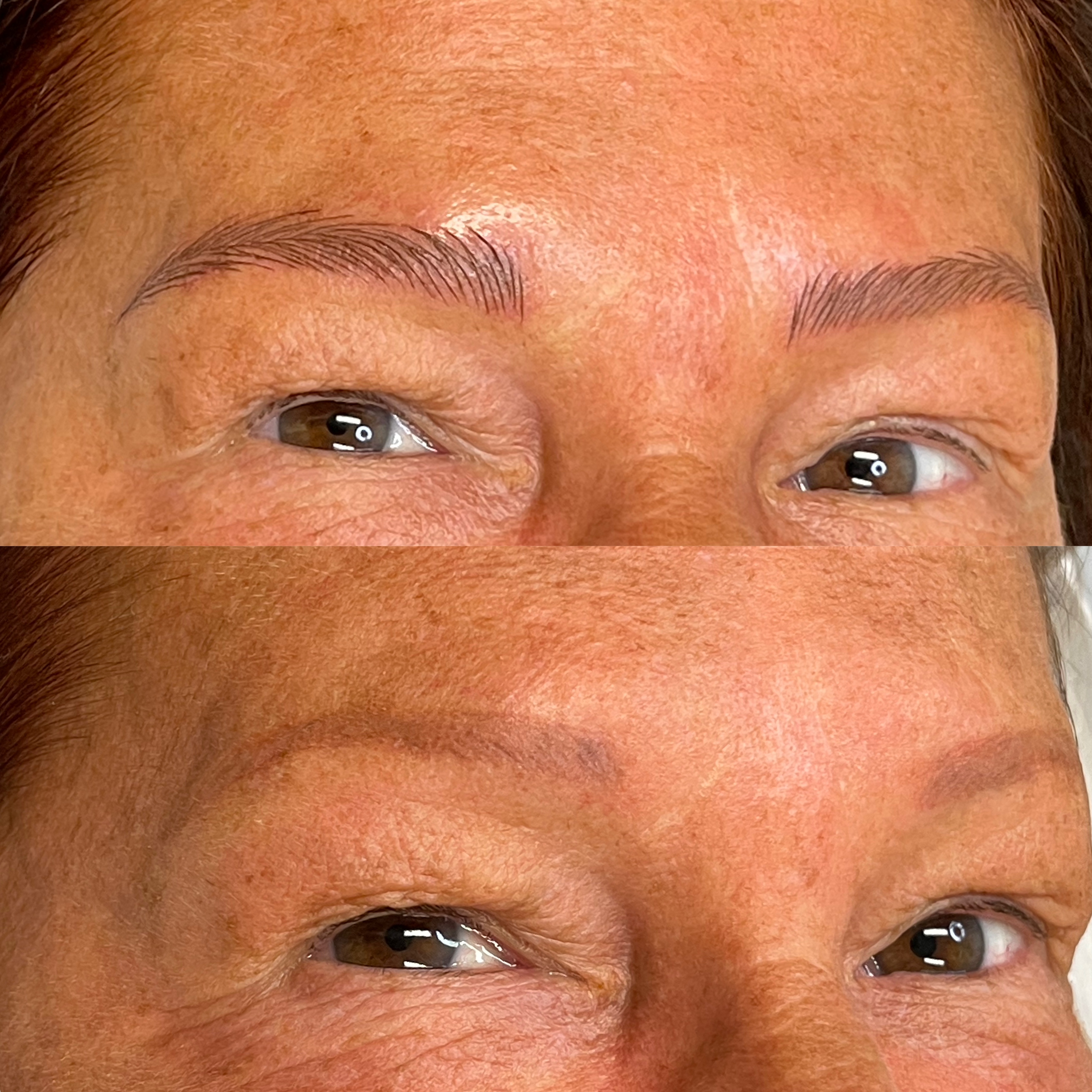 Images Clinique d'Esthétique Leila - Hydrafacial, Microblading, Épilation Laser Sainte-Foy
