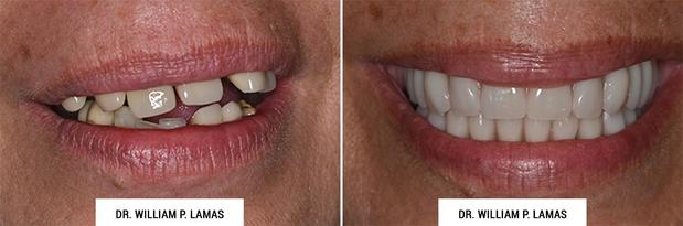 Images William P. Lamas, DMD - Periodontics & Dental Implants