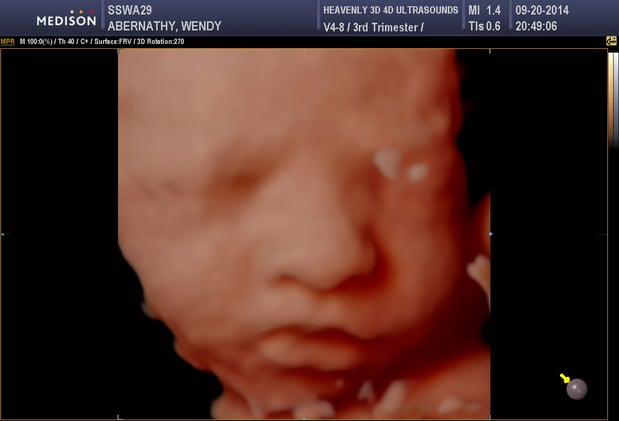 Images Heavenly 3D 4D Ultrasounds-Upland