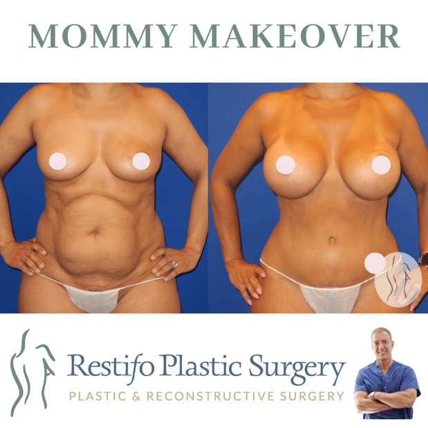 Images Restifo Plastic Surgery