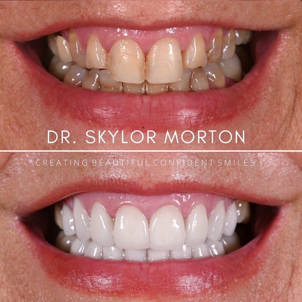 Images Nashville Wisdom Teeth and Implant Solutions