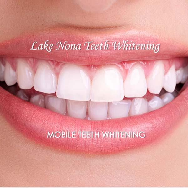 Images Lake Nona Teeth Whitening
