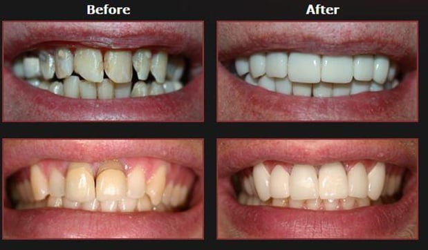 Images Bruce Parker DMD