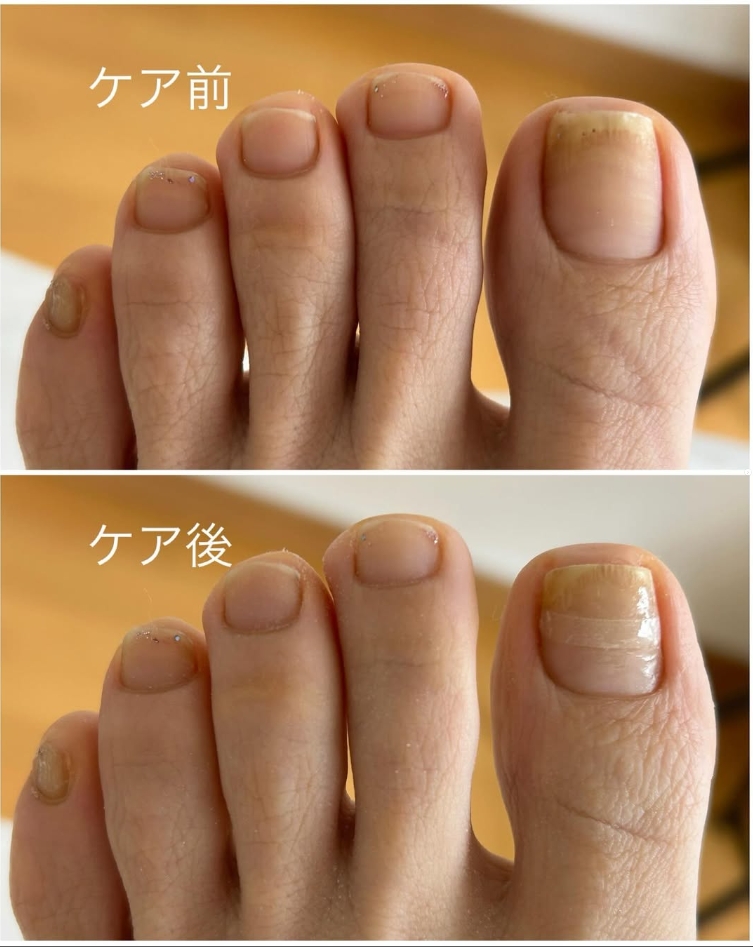 Images 足の専門店 おん