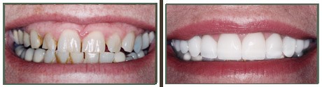 Images Tierrasanta Plaza Dental