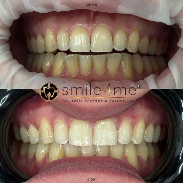 Images smile4me Dental Care - Astoria, Queens