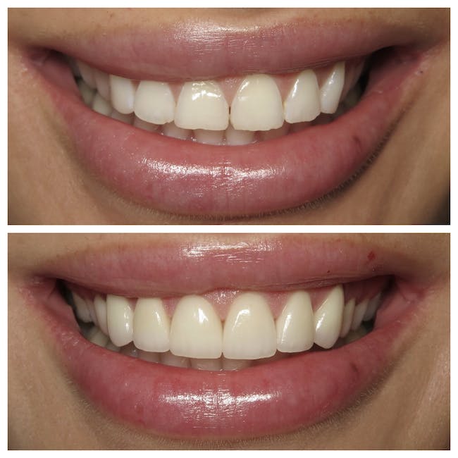Images White Pine Dental
