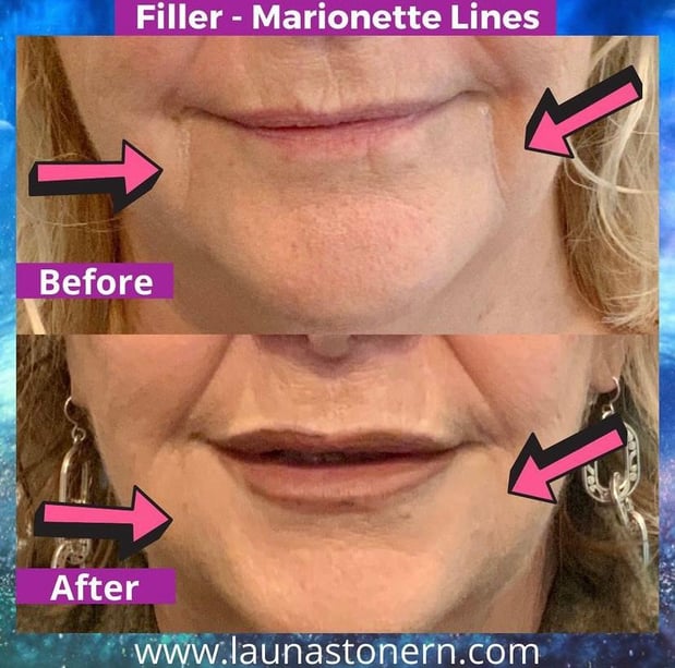 Images Launa Stone, R.N.