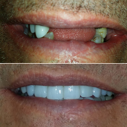 Images Advanced Dentistry & Implant Center