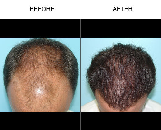 Tampa Hair Restoration Center Photo