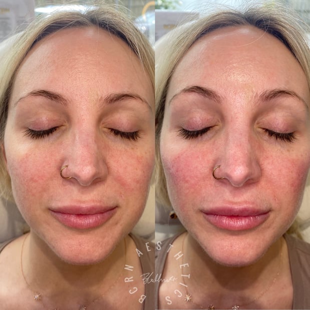 Images BCRN Aesthetics MedSpa