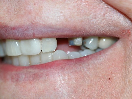 Images Martin Dentistry