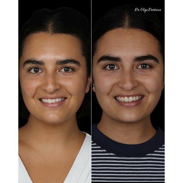 Images Modern Smile Design