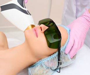 Professional Skin and Facial Laser Treatments