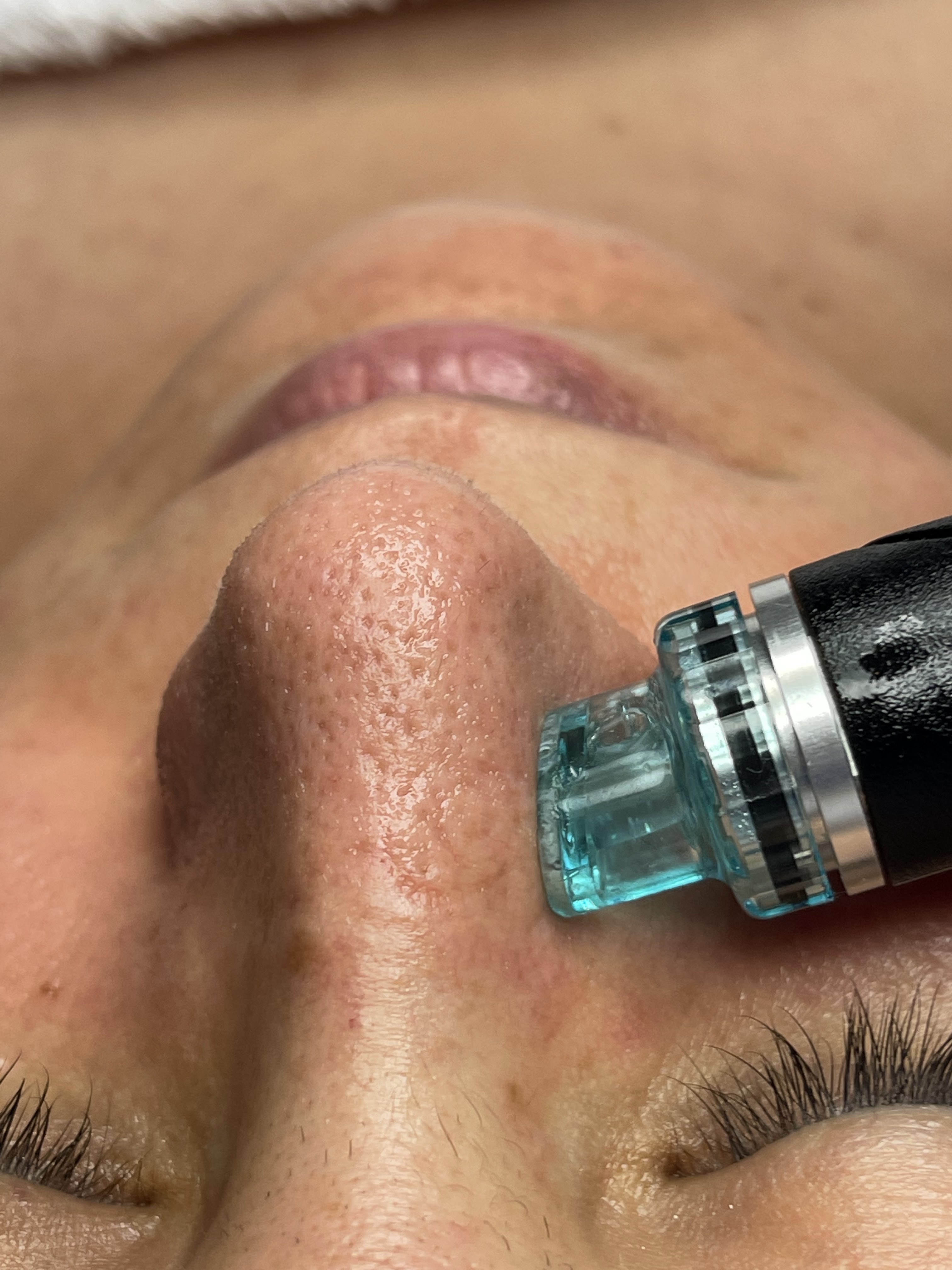 Images Clinique d'Esthétique Leila - Hydrafacial, Microblading, Épilation Laser Sainte-Foy