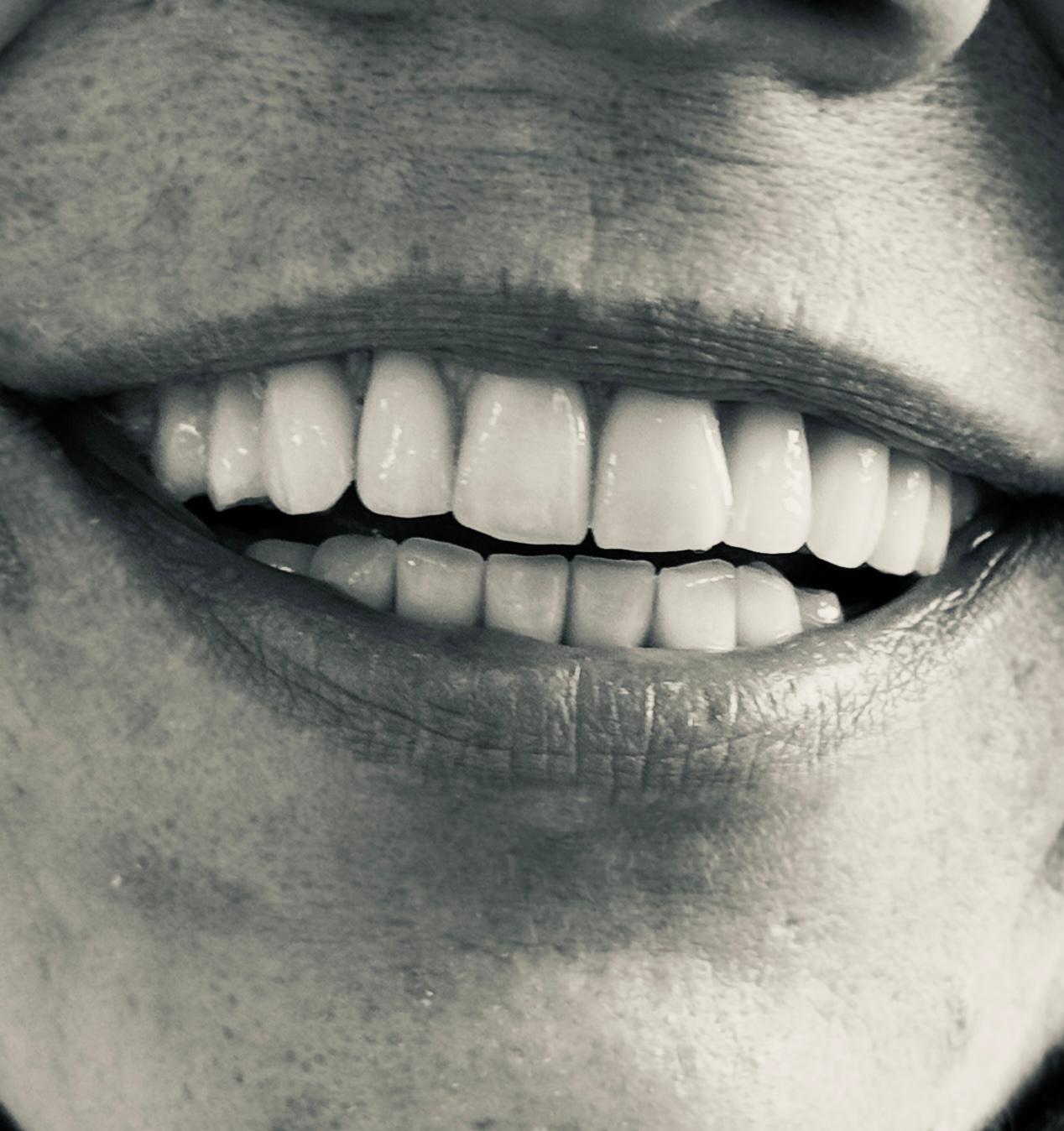 Bilder DentalLook Sagl