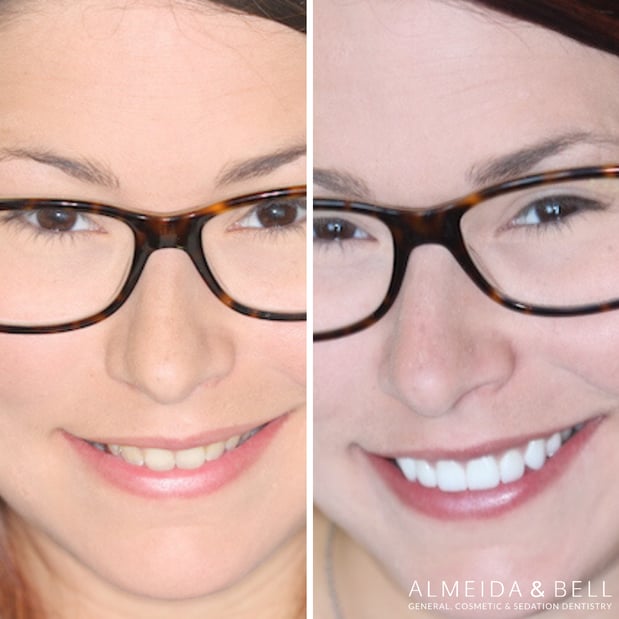 Images Almeida & Bell Dental Lone Tree - General, Cosmetic, and Implant Dentistry