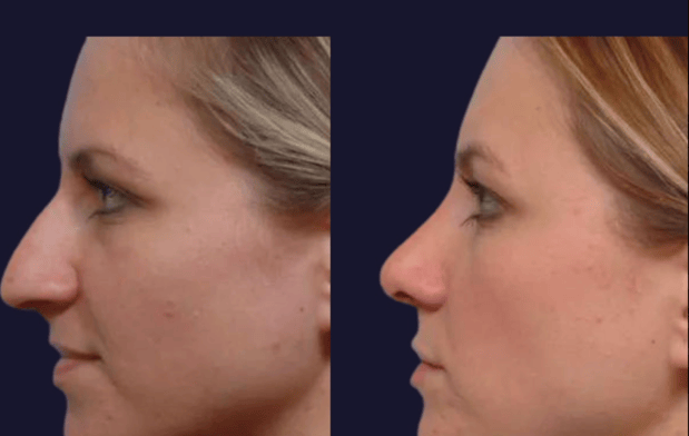 Images The Plastic Surgery Group