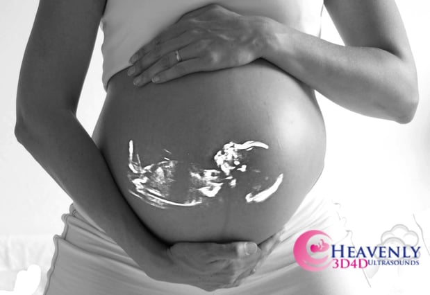 Images Heavenly 3D 4D Ultrasounds