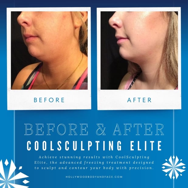 Images Hollywood Body & Face Colorado Springs