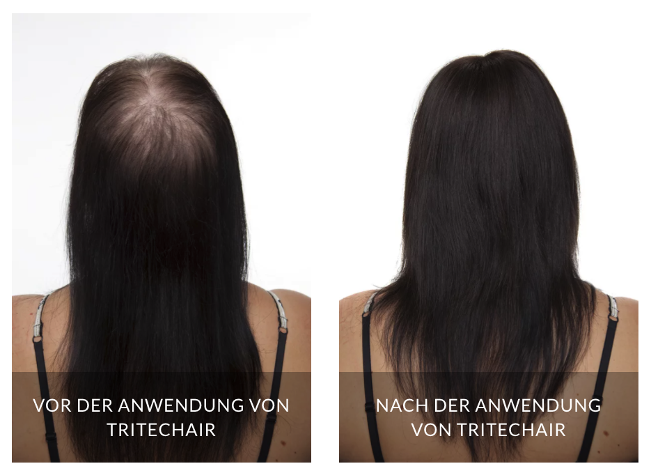 Bilder Tritec-Hair®