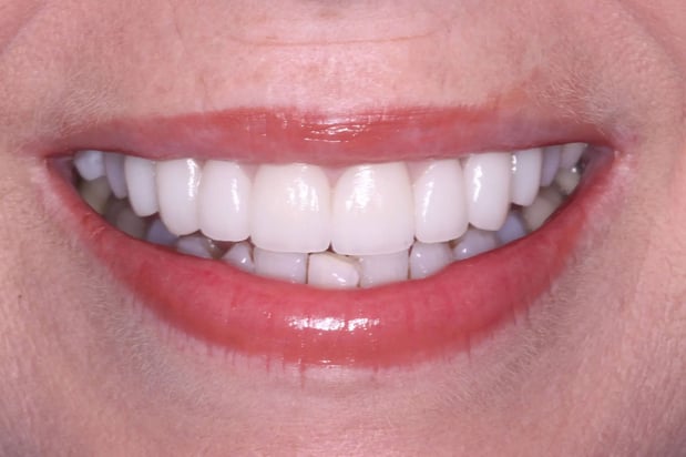 Images SmileCare Dental