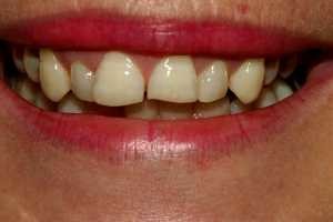 Images Tierrasanta Plaza Dental