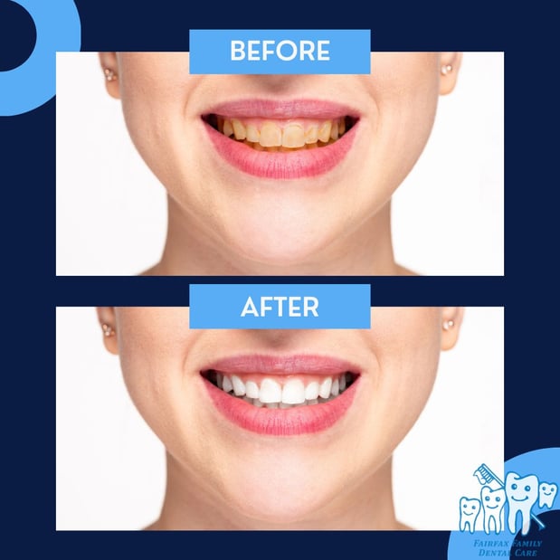 Images Fairfax Family Dental Care