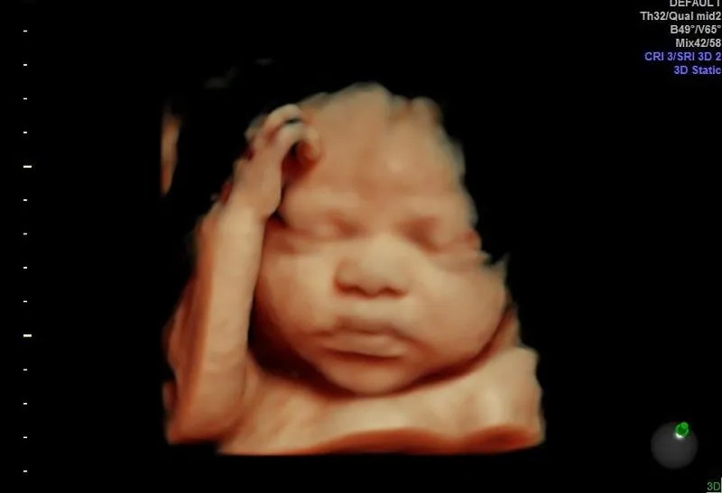 Images Maternity Imaging