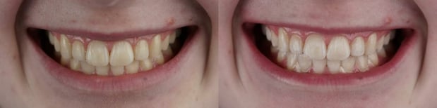 Images Watters Creek Dental