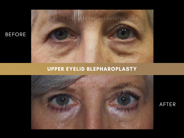 Images Plastic Eye Surgery Associates, PLLC