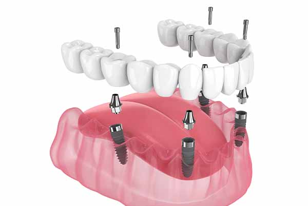 Images Dental Care Arlington Heights