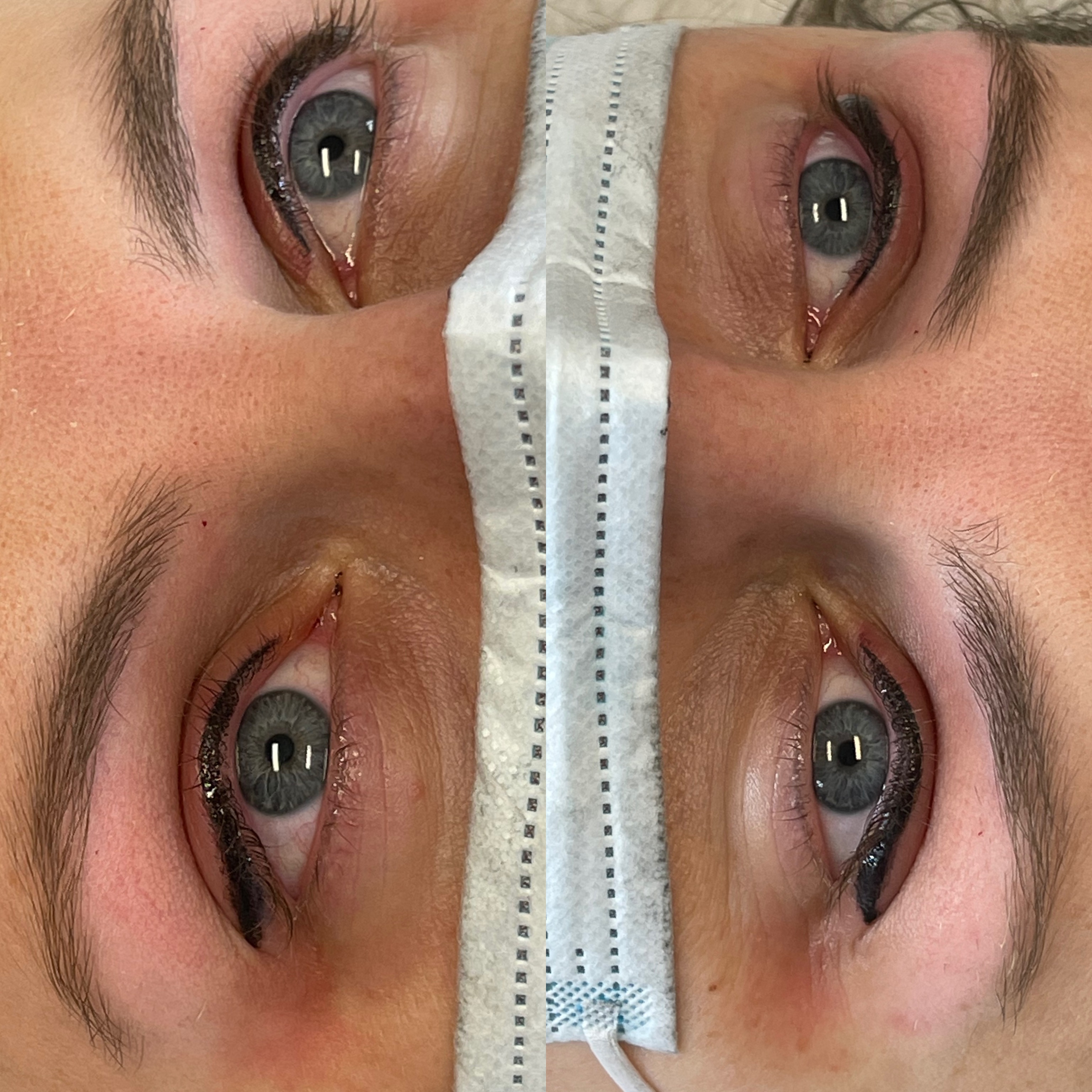 Images Clinique d'Esthétique Leila - Hydrafacial, Microblading, Épilation Laser Sainte-Foy