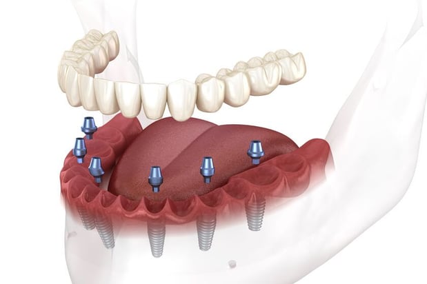 Images Mt. Pleasant Modern Dentistry