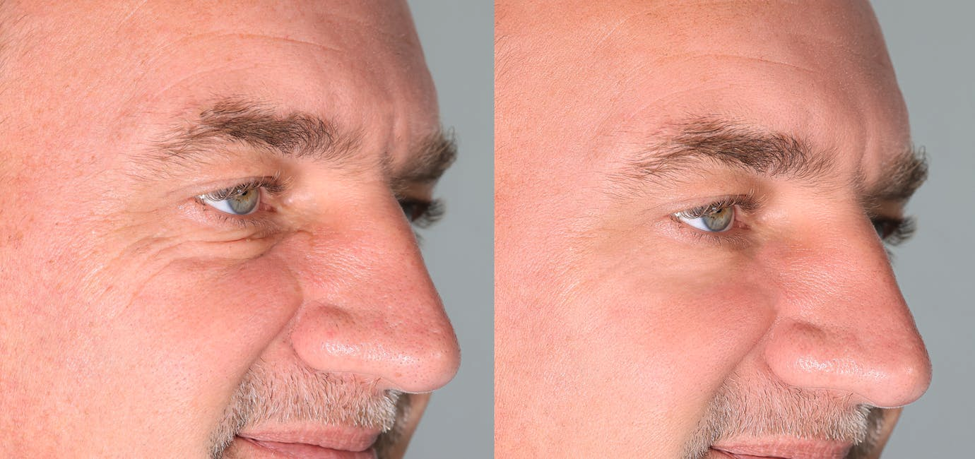 Lee Facial Plastic Surgery