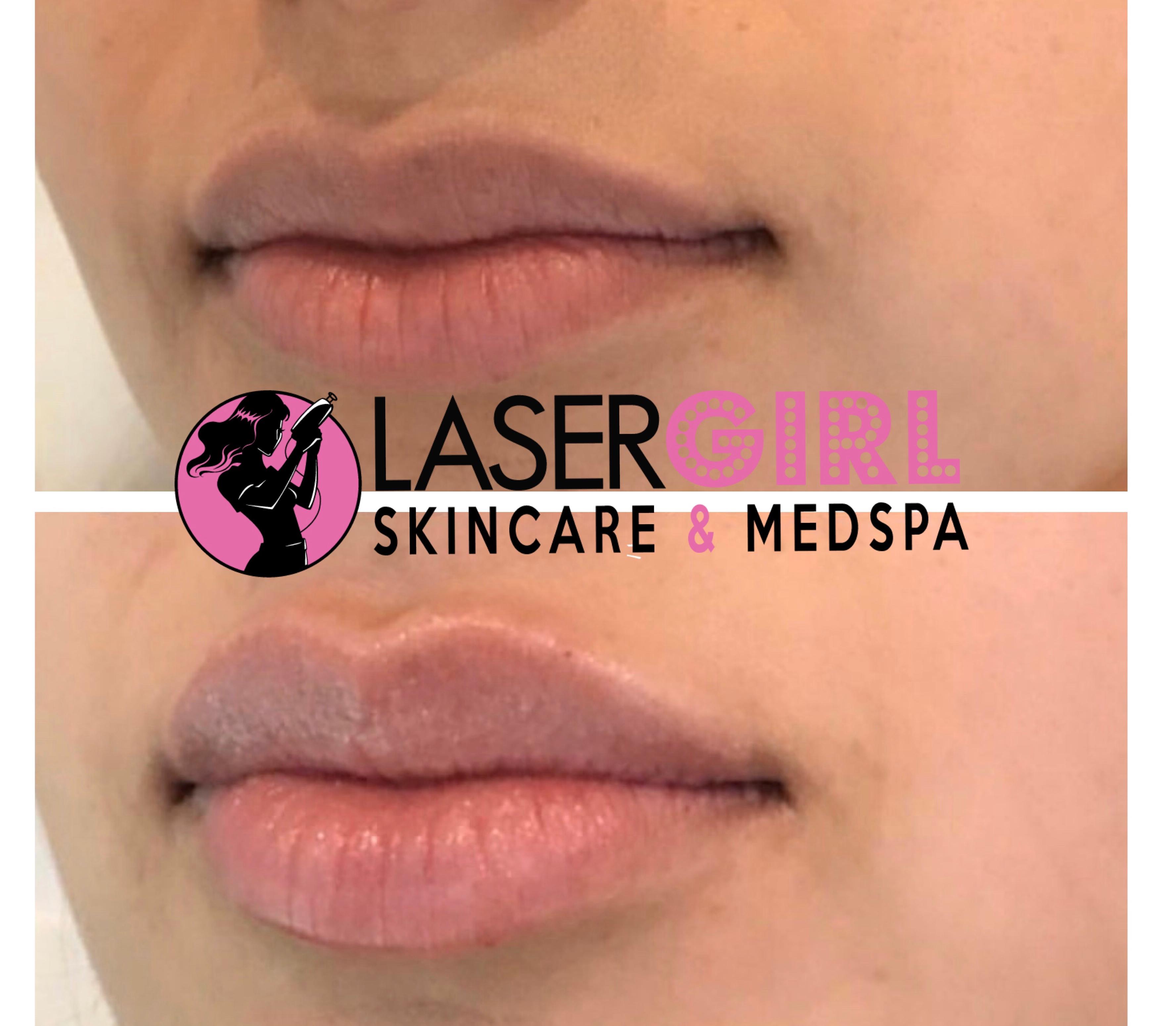 Laser Girl SkinCare & Med Spa Photo