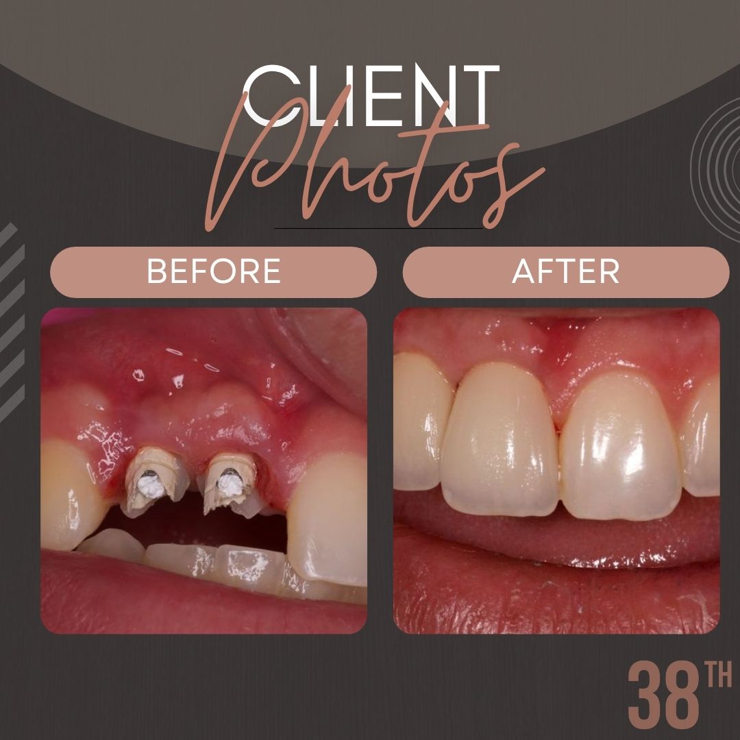 38th Street Dental | Austin, TX