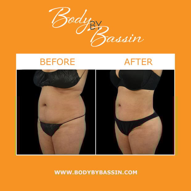 Images Body By Bassin Melbourne