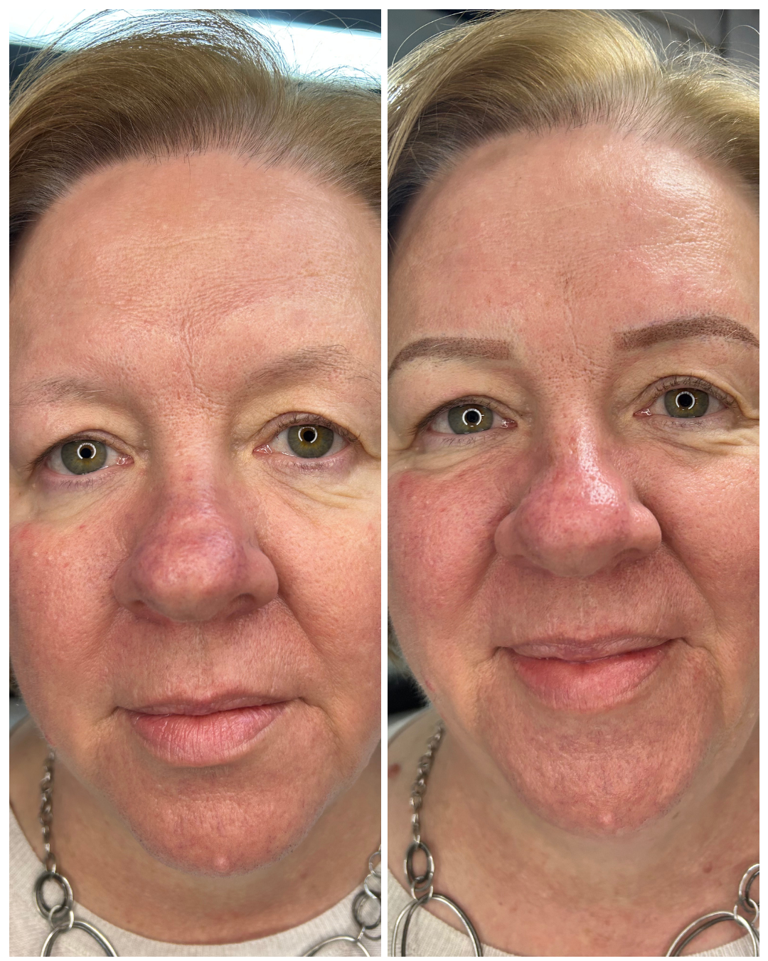 Images Lemonade Brows