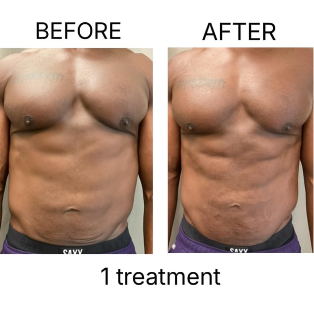 Images Sunkissed Med Spa