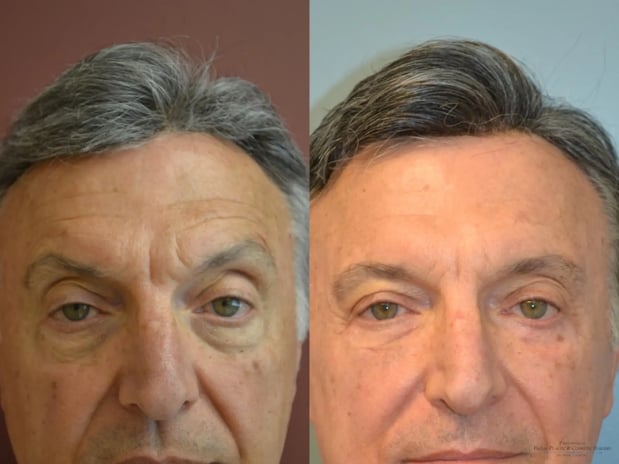 Images Providence Facial Plastic and Cosmetic Surgery