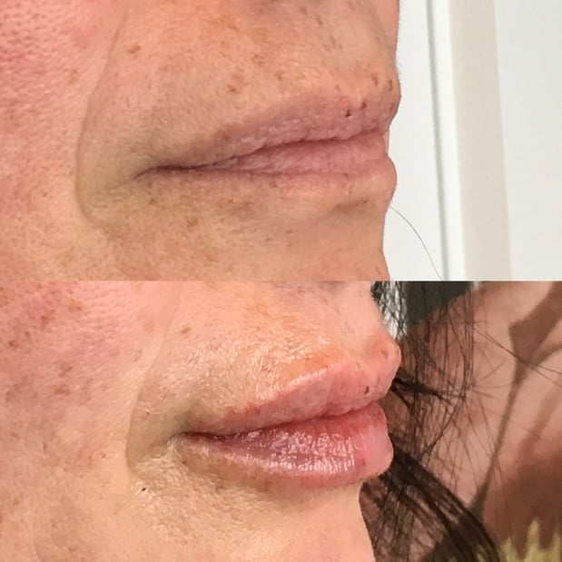 Images BCRN Aesthetics MedSpa