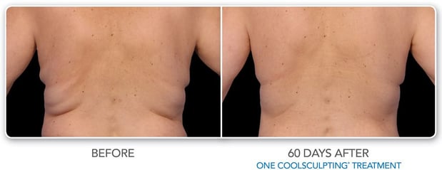 Images Hollywood Body & Face Denver/Metro
