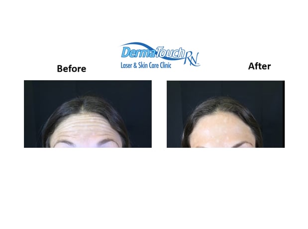 Images DermaTouch RN