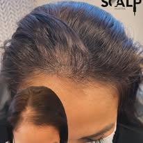 Images The Scalp Master