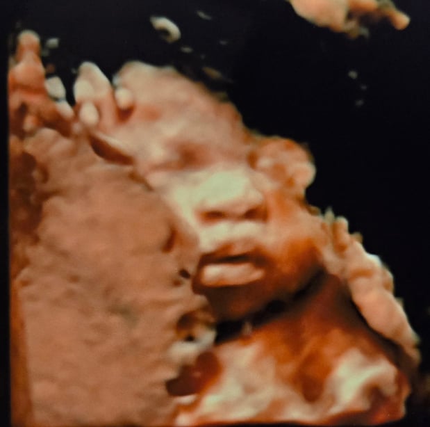 Images Love At First Sight 3D/4D Ultrasound Imaging Studio, LLC