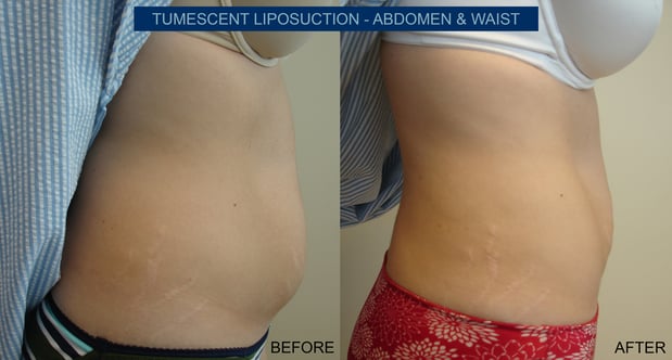 Images A. Bonelli, MD