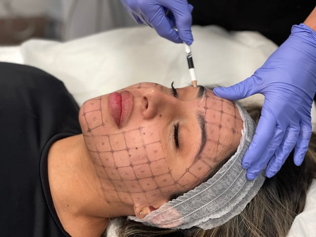 Images BodyLase Med Spa